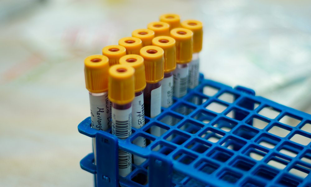 Testosteroncypionaat: oestrogene en progestagene effecten